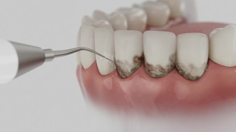 Reliable Dental Implants contractor in Rome, IL by Smile Center Dentistry